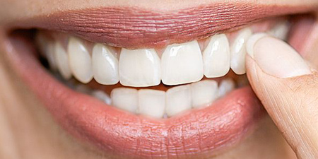 Zahnfleischentzündung